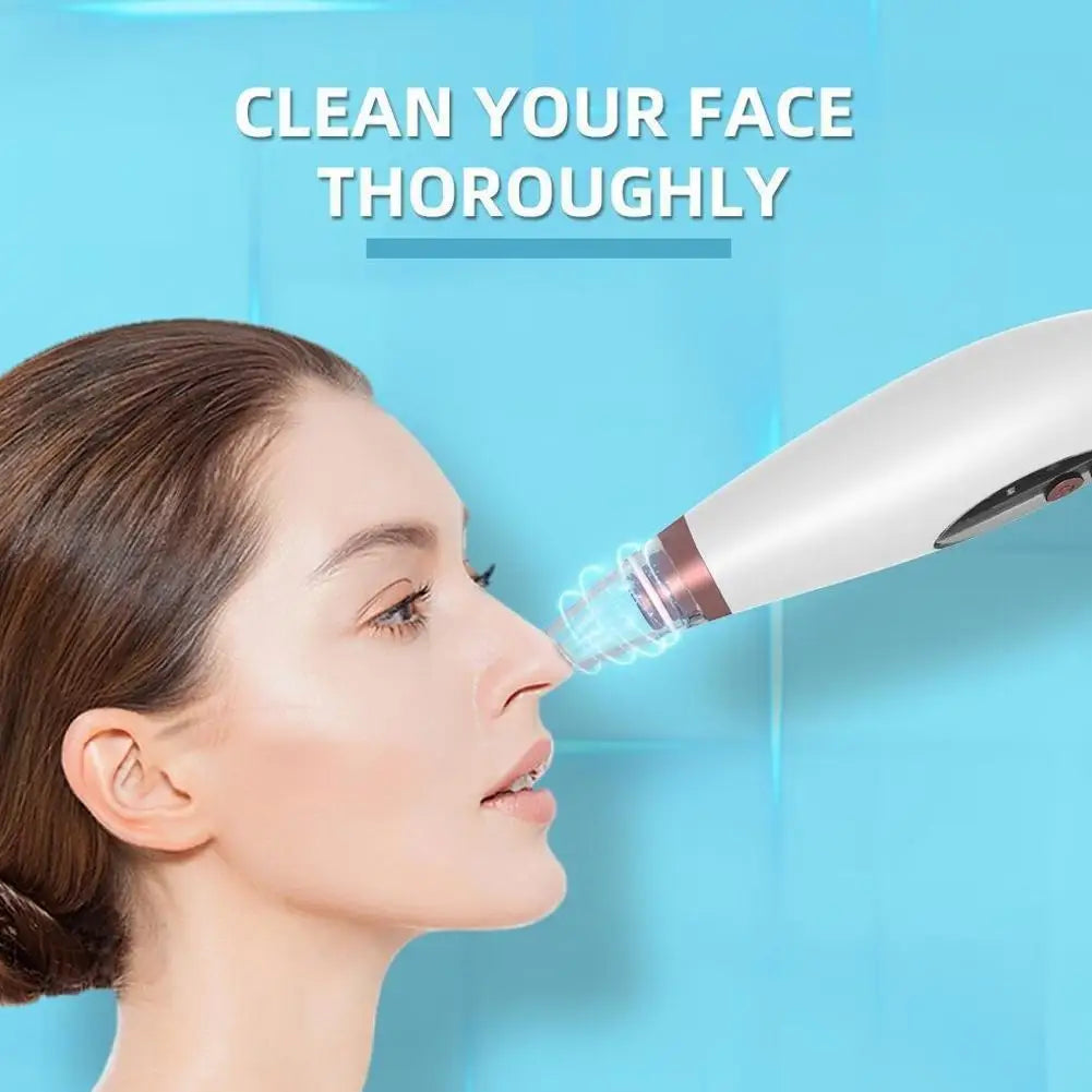 Electric Blackhead Remover