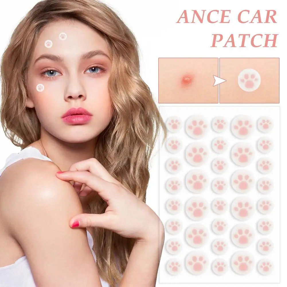 Cute Cat Paw Acne Pimple Patch