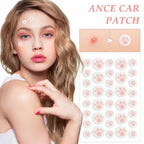 Cute Cat Paw Acne Pimple Patch