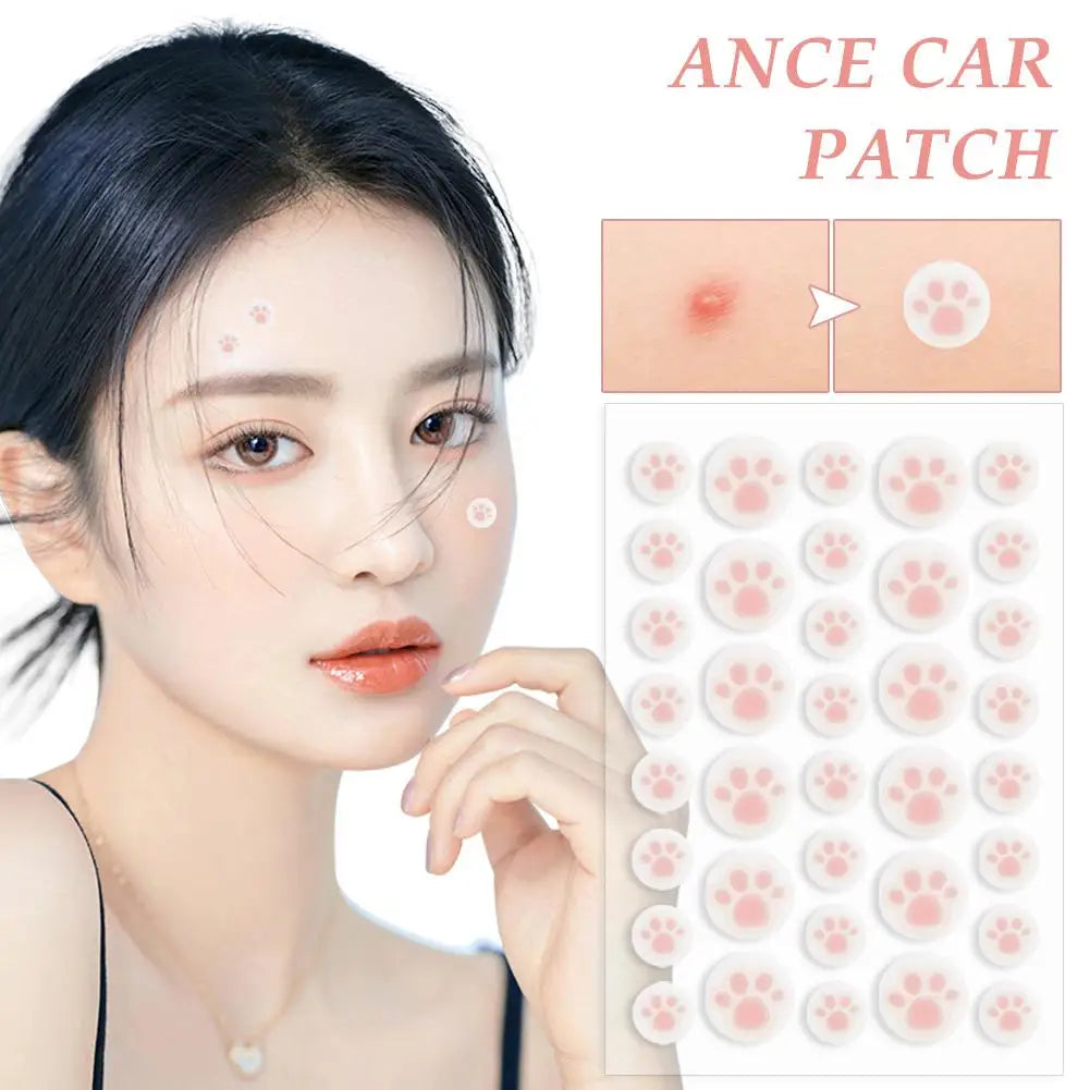 Cute Cat Paw Acne Pimple Patch