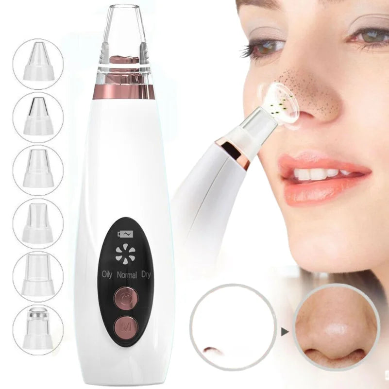 Electric Blackhead Remover
