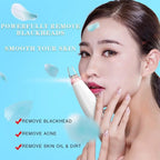 Electric Blackhead Remover
